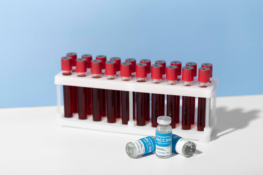 مزایای استفاده از کیت PRP گرینر اتریشی