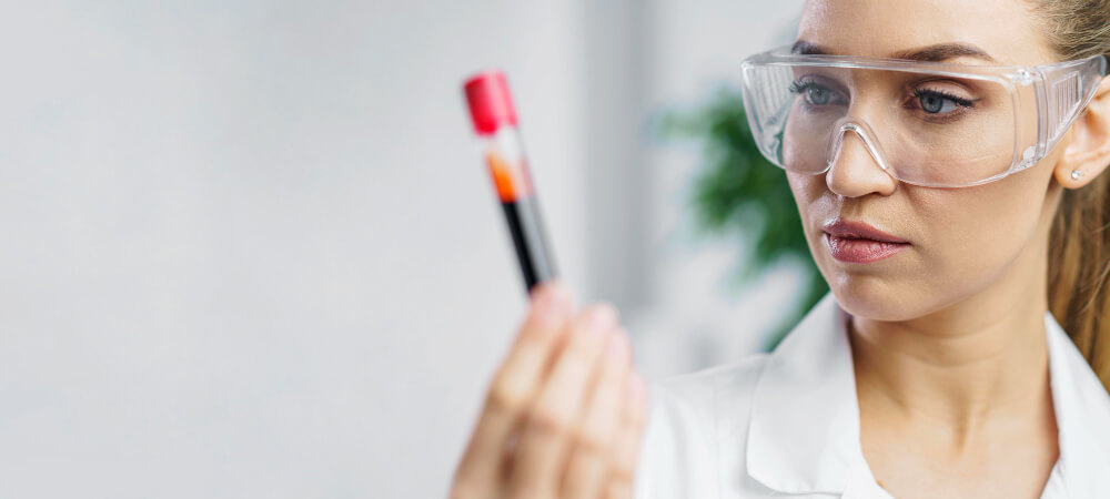 کیت PRP برند (Platelet-Rich Plasma) BD
