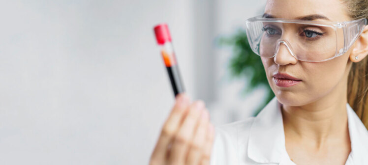کیت PRP برند (Platelet-Rich Plasma) BD