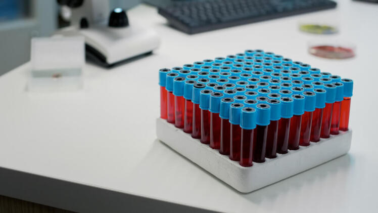 کیت PRP گرینر (greiner) اتریشی