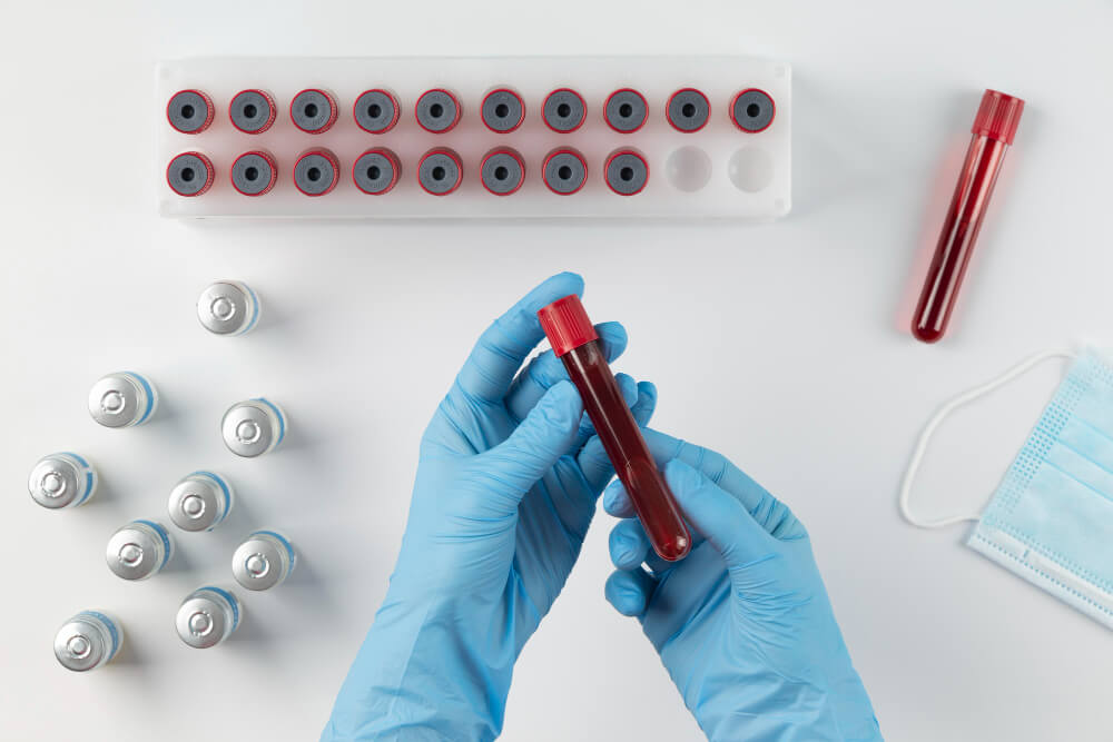 کیت PRP چیست و چگونه کار میکند؟